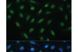 Immunofluorescence analysis of U-2 OS cells using ATF3 Polyclonal Antibody at dilution of 1:100. (ATF3 抗体)