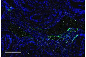 Immunohistochemistry analysis using Mouse Anti-VPS35 Monoclonal Antibody, Clone 10A8 (ABIN6932992). (VPS35 抗体  (Biotin))