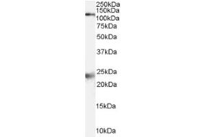 Image no. 1 for anti-NMDA Receptor 1 (NMDA R1) (Internal Region) antibody (ABIN374717) (NMDA 1 Receptor 抗体  (Internal Region))