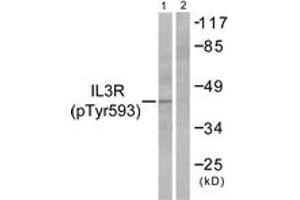 Western blot analysis of extracts from RAW264. (CSF2RB2 抗体  (pTyr593))