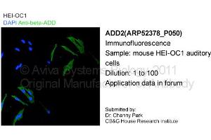 Image no. 2 for anti-Adducin 2 (Beta) (ADD2) (Middle Region) antibody (ABIN2784900) (ADD2 抗体  (Middle Region))