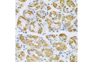 Immunohistochemistry of paraffin-embedded human stomach using SDC4 Antibody (ABIN1874710) at dilution of 1:100 (40x lens). (SDC4 抗体)
