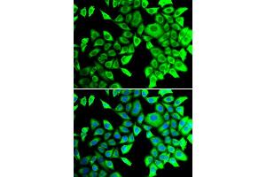 Immunofluorescence analysis of A549 cell using THADA antibody. (THADA 抗体)