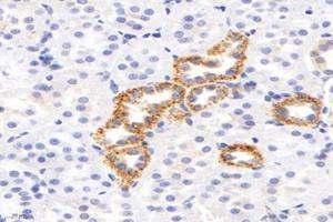 Immunohistochemistry analysis of paraffin-embedded rat kidney using,IVD (ABIN7074382) at dilution of 1: 2800 (IVD 抗体)