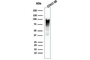 Western Blot Analysis of COLO-38 cell lysate using gp100 Mouse Monoclonal Antibody (PMEL/2038). (Melanoma gp100 抗体  (AA 376-502))