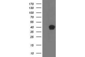 HEK293T cells were transfected with the pCMV6-ENTRY control (Left lane) or pCMV6-ENTRY RLBP1 (Right lane) cDNA for 48 hrs and lysed. (RLBP1 抗体)