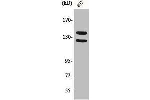 Western Blot analysis of 293 cells using Phospho-Flg (Y154) Polyclonal Antibody (FGFR1 抗体  (pTyr154))