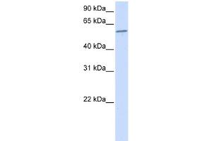 WB Suggested Anti-PPP3CA Antibody Titration:  0. (PPP3CA 抗体  (N-Term))