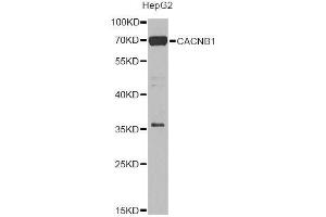 Western blot analysis of extracts of HepG2 cells, using CACNB1 Antibody. (CACNB1 抗体  (AA 429-598))