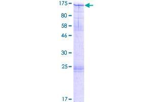 Image no. 1 for Minichromosome Maintenance Deficient 10 (MCM10) (AA 1-874) protein (GST tag) (ABIN1310546) (MCM10 Protein (AA 1-874) (GST tag))