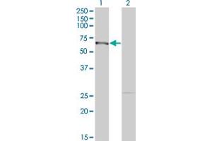 Western Blot analysis of DMAP1 expression in transfected 293T cell line by DMAP1 monoclonal antibody (M03), clone 5H4. (DMAP1 抗体  (AA 1-100))