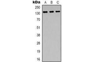 Western blot analysis of ABL1 expression in Hela (A), SHSY5Y (B), NIH3T3 (C) whole cell lysates. (ABL1 抗体)