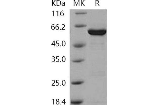 GALK1 Protein (GST tag,His tag)