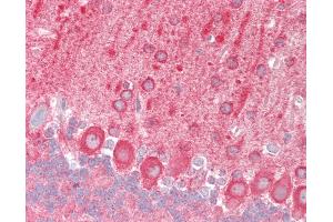 Mouse Brain, Cerebellum: Formalin-Fixed, Paraffin-Embedded (FFPE) (TRAF6 抗体  (AA 1-305))