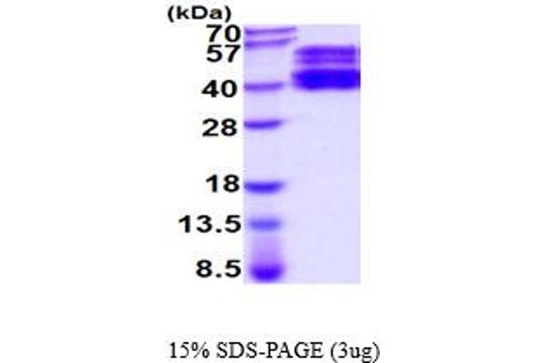 ST6GAL1 Protein (AA 27-406) (His tag)