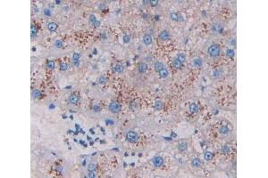 Used in DAB staining on fromalin fixed paraffin- embedded liver tissue (HADH 抗体  (AA 1-236))