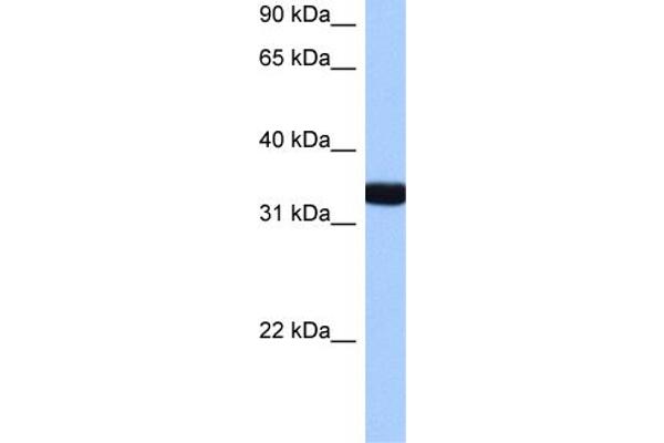 GTPase, IMAP Family Member 1 (GIMAP1) (N-Term) 抗体