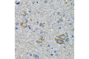 Immunohistochemistry of paraffin-embedded mouse spinal cord using SSBP1 antibody (ABIN5974202) at dilution of 1/100 (40x lens). (SSBP1 抗体)