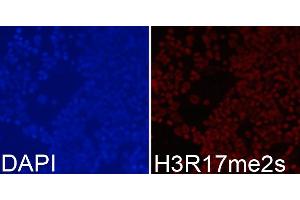 Immunofluorescence analysis of 293T cells using Symmetric DiMethyl-Histone H3-R17 antibody (ABIN3017470, ABIN3017471, ABIN3017472 and ABIN6220102). (Histone 3 抗体  (H3R17me2))