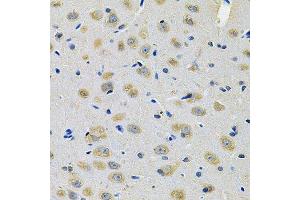 Immunohistochemistry of paraffin-embedded rat brain using TXNDC5 Antibody. (TXNDC5 抗体  (AA 1-324))