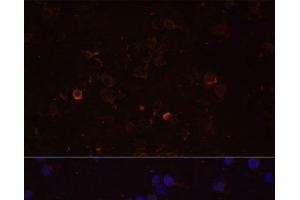 Immunofluorescence analysis of THP-1 cells using TLR4 Polyclonal Antibody at dilution of 1:100 (40x lens). (TLR4 抗体)