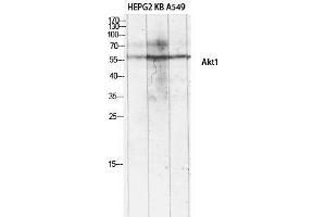 Western Blotting (WB) image for anti-V-Akt Murine Thymoma Viral Oncogene Homolog 1 (AKT1) (Ser134) antibody (ABIN3173743) (AKT1 抗体  (Ser134))