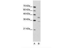 Image no. 1 for anti-DNA Fragmentation Factor, 45kDa, alpha Polypeptide (DFFA) (N-Term) antibody (ABIN203383) (DFFA 抗体  (N-Term))