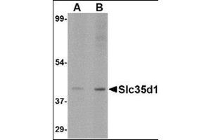 Western blot analysis of Slc35D1 inA-20 lysate with this product at (A) 1 and (B) 2 μg/ml. (SLC35D1 抗体  (N-Term))