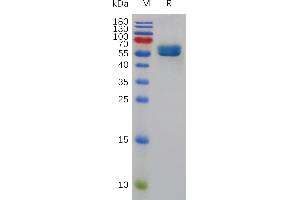 Mouse SL Protein, hFc Tag on SDS-PAGE under reducing condition. (CD84 Protein (CD84) (AA 22-221) (Fc Tag))