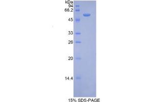 SDS-PAGE analysis of Mouse Ribophorin I Protein. (RPN1 蛋白)