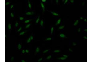 Immunofluorescence staining of Hela Cells with ABIN7127663 at 1:50, counter-stained with DAPI. (Recombinant PAK1 抗体)