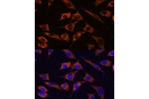 Immunofluorescence analysis of L929 cells using MMP25 antibody (ABIN7268422) at dilution of 1:100. (MMP25 抗体  (AA 350-540))