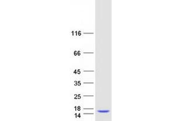 SH3BGRL3 Protein (Myc-DYKDDDDK Tag)