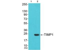 Western Blotting (WB) image for anti-TIMP Metallopeptidase Inhibitor 1 (TIMP1) (Internal Region) antibody (ABIN1848806) (TIMP1 抗体  (Internal Region))