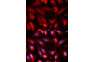 Immunofluorescence analysis of U2OS cells using SMAD4 antibody (ABIN5973302). (SMAD4 抗体)