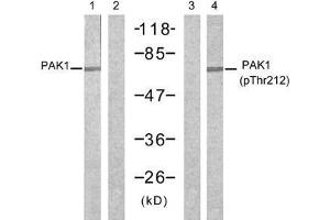 Western blot analysis of extracts from 293 cells, untreated or treated with forskolin (40µM, 30min), using PAK1 (Ab-212) antibody (E021160, Lane 1 and 2) and PAK1 (phospho-Thr212) antibody (E011154, Lane 3 and 4). (PAK1 抗体)