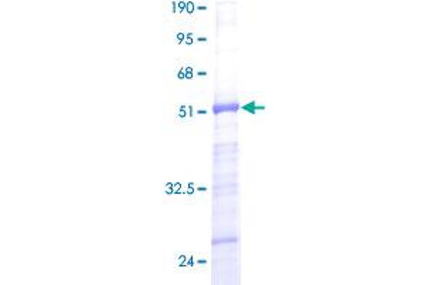 RPS5 Protein (AA 1-204) (GST tag)