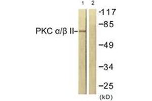 Western blot analysis of extracts from NIH-3T3 cells, treated with UV 15', using PKC alpha (Ab-638) Antibody. (PKC alpha 抗体  (AA 606-655))