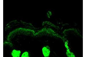 Immunofluorescence (IF) image for anti-Calreticulin (CALR) antibody (ABIN6656052)