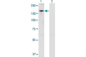 Western Blot analysis of ADNP expression in transfected 293T cell line by ADNP monoclonal antibody (M02), clone 2C5. (ADNP 抗体  (AA 1018-1102))