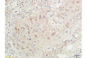 Immunohistochemistry (Paraffin-embedded Sections) (IHC (p)) image for anti-Proliferating Cell Nuclear Antigen (PCNA) (AA 151-261) antibody (ABIN676583)