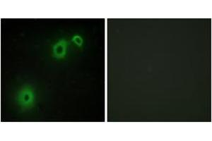Immunofluorescence (IF) image for anti-Nerve Growth Factor Receptor (NGFR) (AA 121-170) antibody (ABIN2889383) (NGFR 抗体  (AA 121-170))
