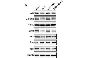 SIRT3 protected mitochondrial fusion proteins Mfn1 and Mfn2 after SAH in an AMPK-dependent manner. (MFN1 抗体  (AA 622-741))