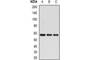 Western blot analysis of ALPP expression in HepG2 (A), rat testis (B), rat liver (C) whole cell lysates. (PLAP 抗体)