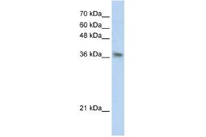 WB Suggested Anti-PHYHIP Antibody Titration:  0. (PHYHIP 抗体  (N-Term))