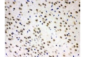 IHC testing of FFPE rat brain with AZIN2 antibody at 1ug/ml. (ADC 抗体)