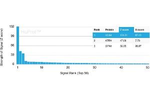 Analysis of Protein Array containing >19,000 full-length human proteins using CD68 Mouse Monoclonal Antibody (C68/2501) Z- and S- Score: The Z-score represents the strength of a signal that a monoclonal antibody (Monoclonal Antibody) (in combination with a fluorescently-tagged anti-IgG secondary antibody) produces when binding to a particular protein on the HuProtTM array. (CD68 抗体  (AA 150-221))