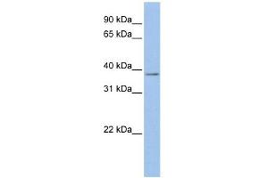Mesothelin antibody used at 1 ug/ml to detect target protein. (Mesothelin 抗体  (Middle Region))