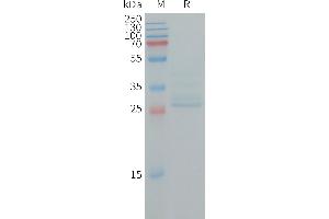 Human N Protein, hFc Tag on SDS-PAGE under reducing condition. (NINJ1 Protein (AA 1-80) (Fc Tag))