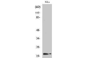 Western Blotting (WB) image for anti-Cyclin-Dependent Kinase Inhibitor 1A (p21, Cip1) (CDKN1A) (pThr145) antibody (ABIN3182099) (p21 抗体  (pThr145))